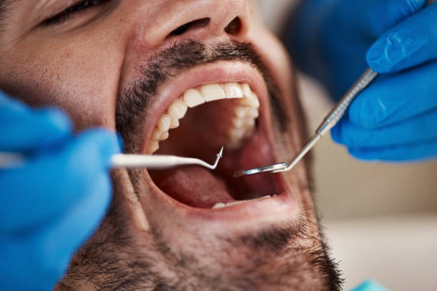 Best Preventive Dentistry  in Finley, WA